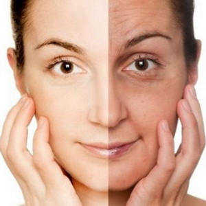 Làm đẹp không phẫu thuật cho phụ nữ trung niên