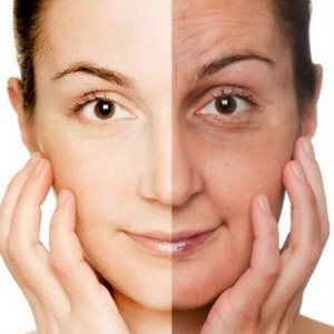 CHỐNG LÃO HÓA THEO ĐỘ TUỔI