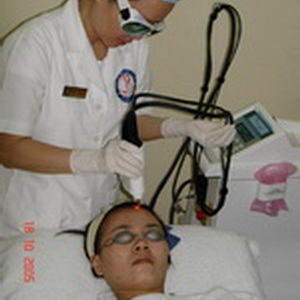 Trị mụn bằng Laser