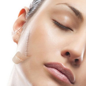 Điều trị sẹo lồi