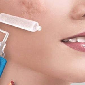 Lựa chọn trong điều trị sẹo lồi