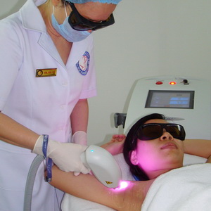 Triệt lông không đau bằng Laser thế hệ mới