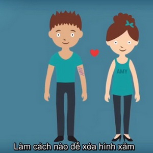 Điều gì xảy ra khi xóa hình xăm bằng tia laser