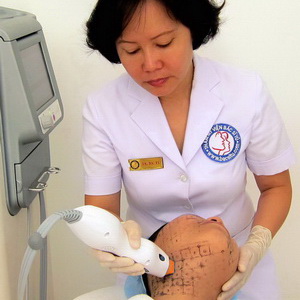 Trẻ hóa da không phẫu thuật với Thermage