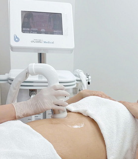 CFU ÈLIFE – Bước tiến mới trong trẻ hóa da & thon gọn không xâm lấn