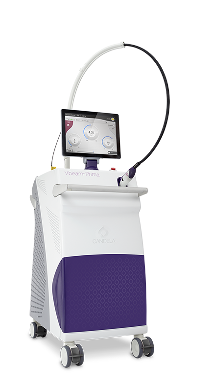 Laser Vbeam Prima <br>(Mỹ)